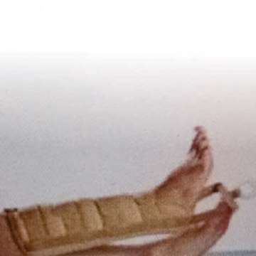 Leg Traction Brace